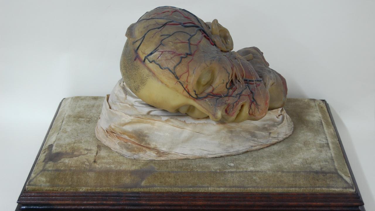 Imagen representativa de la Colección Médica de Modelos Anatómicos