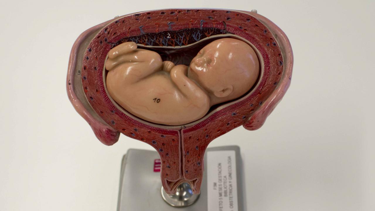 Modelo anatómico de un feto en presentación transversa realizado en caucho coloreado sobre peana de metal