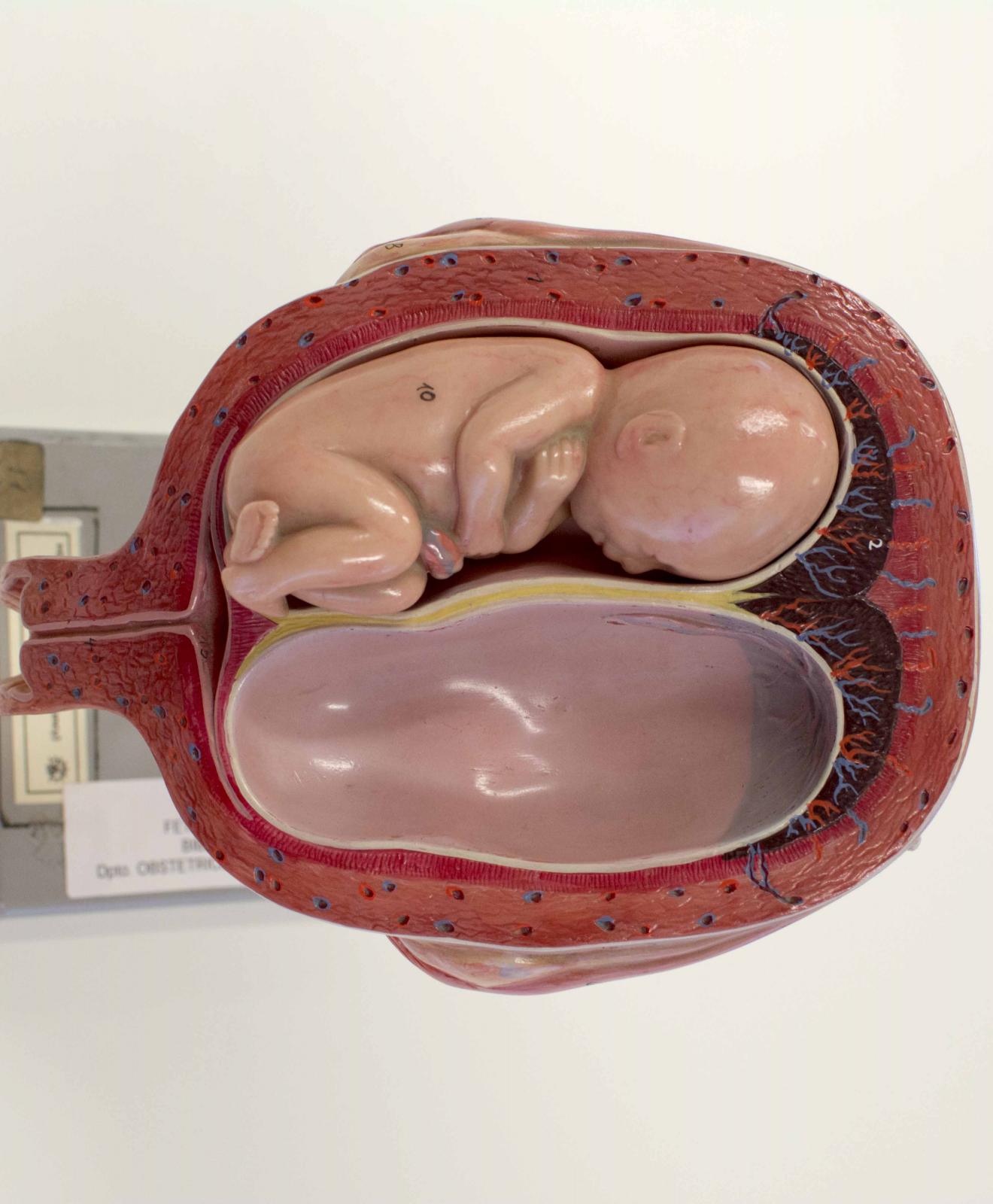 Recreación realista de la cavidad fetal en un embarazo de gemelos. El hueco en el que se mostraría el segundo feto está vacío. Al fondo se distingue una peana metálica, gris con etiquetas