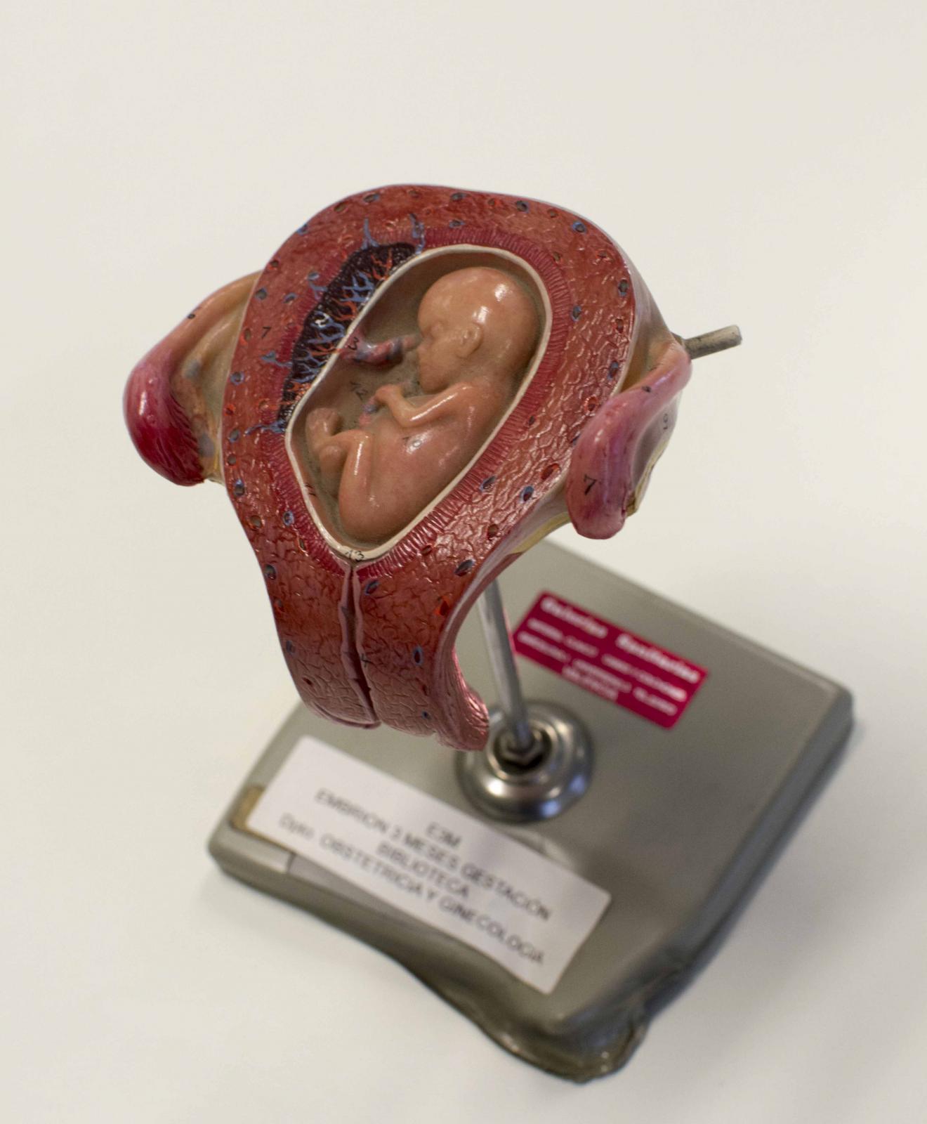 Representación realista de la cavidad uterina y un feto en su interior, sobre peana metálica gris
